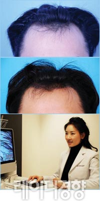 헤어라인